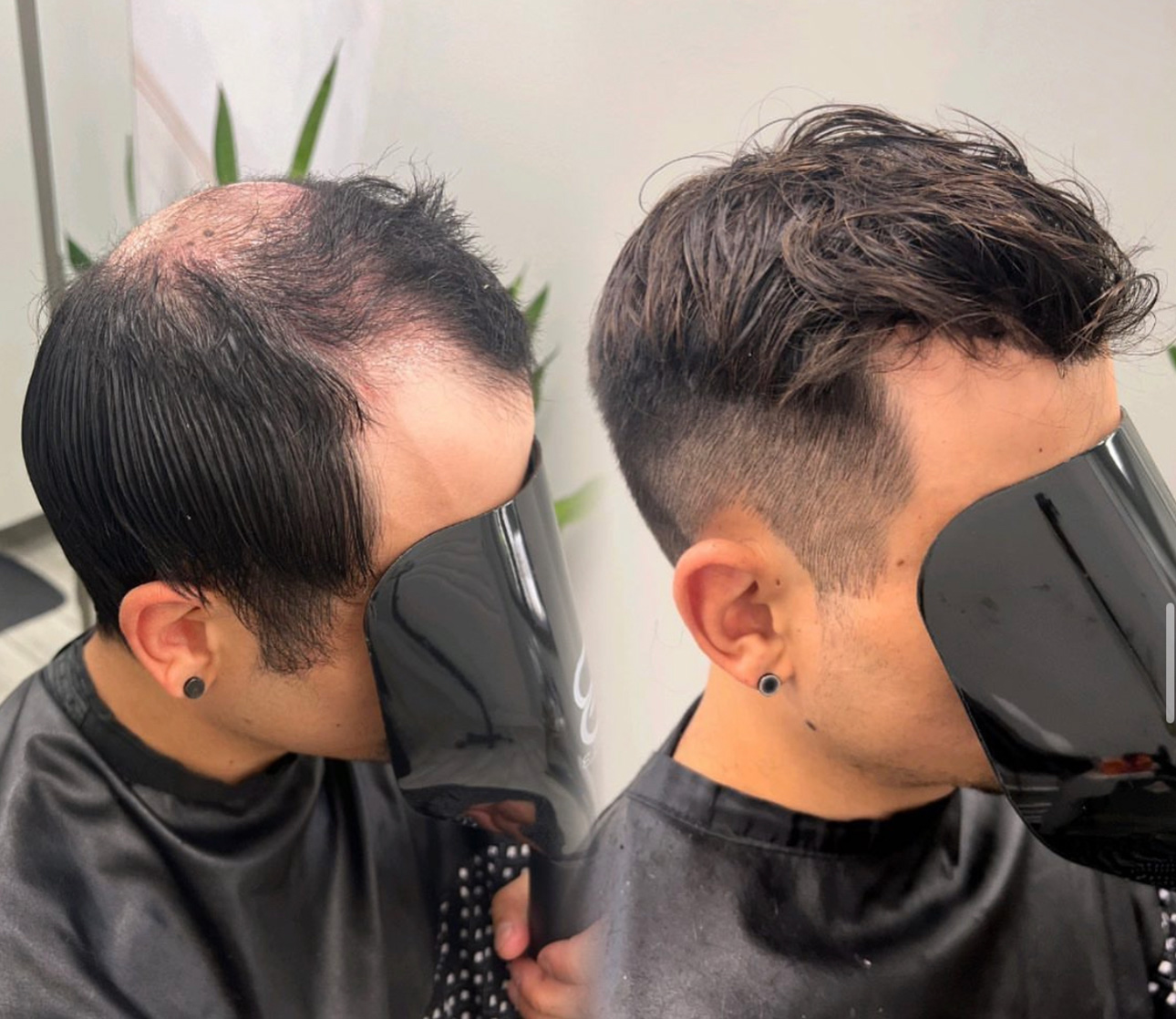 Men's hair system before-and-after result