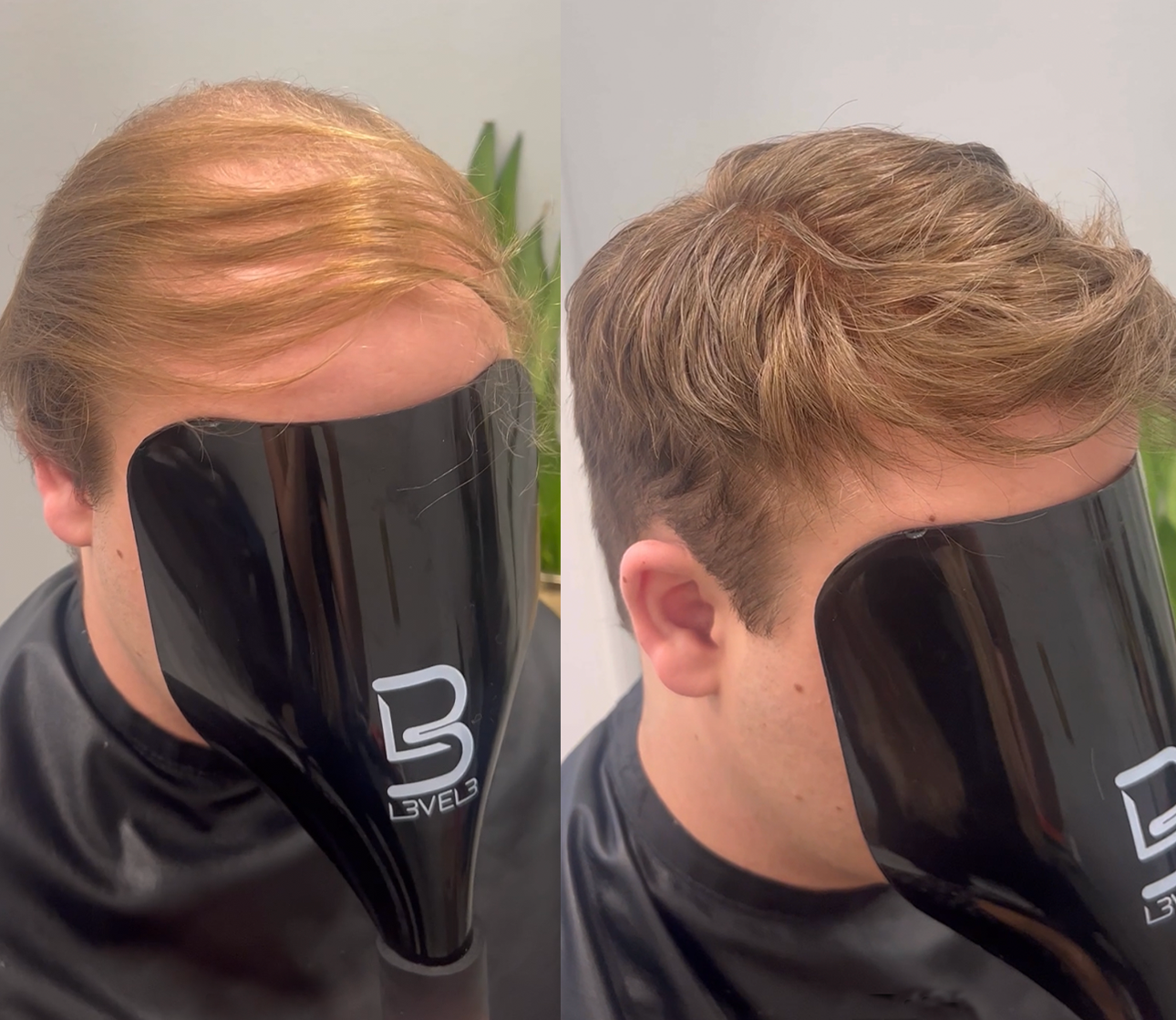 Men's hair system transformation from thinning hair to a curly style