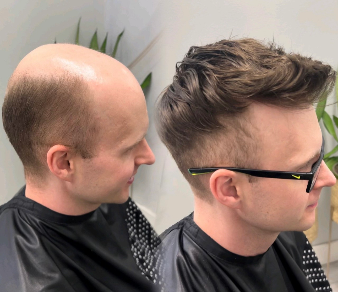 Before-and-after men's hair replacement result with a dark styled hair system
